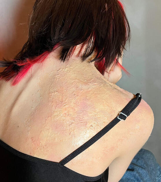 Tissue Paper and Latex Burn | applied by AnnaLee