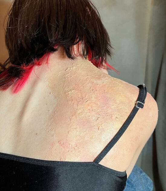 Tissue Paper and Latex Burn | applied by AnnaLee